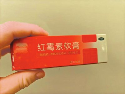 红霉素软膏不能随意使用。叶红摄