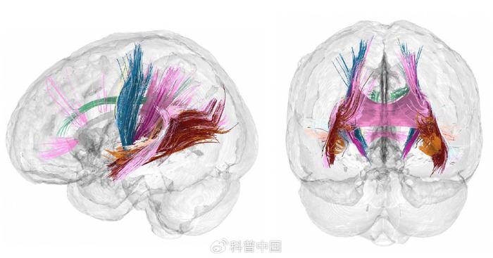 主要白质束的微观结构集中性随着孕期的增加而增加。图片来自Daniela Cossio