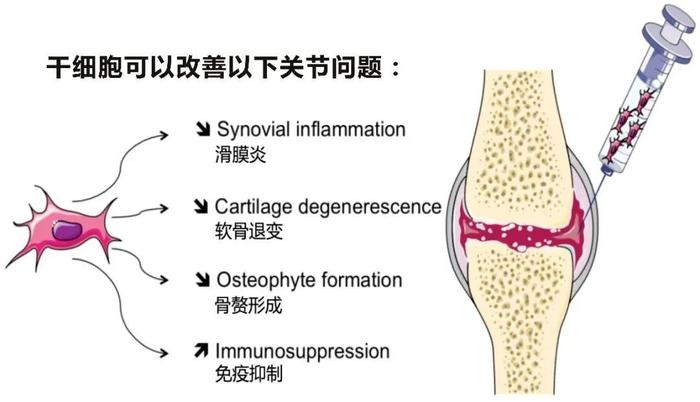 △ 干细胞可改善的骨关节问题