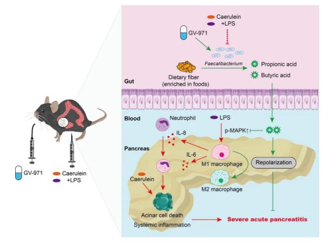 图6. 甘露特钠治疗重症急性胰腺炎的分子机制（图源：Nature Communications）