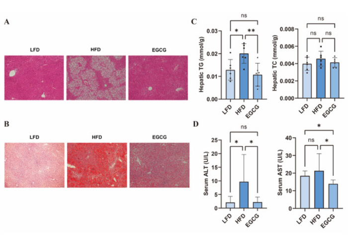 图3：EGCG 可减轻高脂饮食引起的肝损伤并减少肝脏脂质蓄积