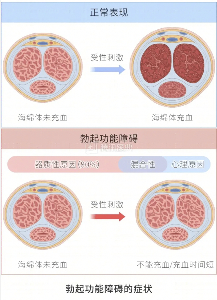 图源：腾讯医典