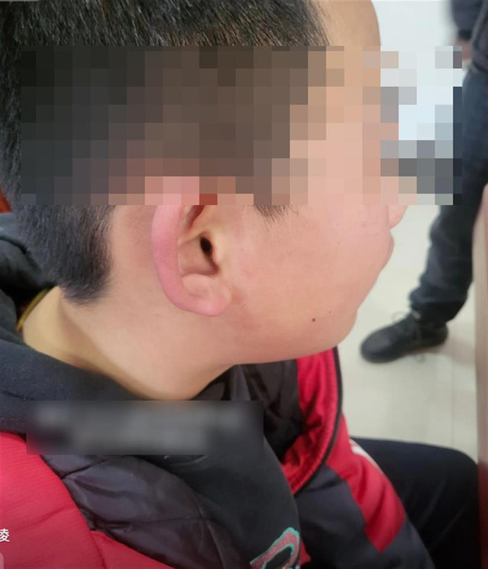 孩子被打 （图片源自网络）