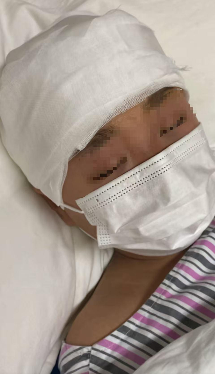 治疗期间的辰辰。图源：受访者供图