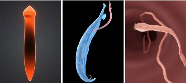 从左至右：涡虫、吸虫、绦虫 图源：iStock