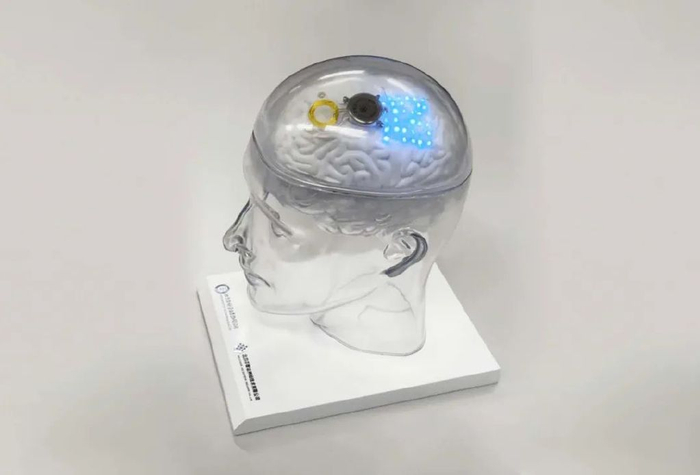 半侵入式脑机接口“北脑一号”。受访者供图