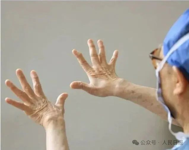 吴孟超展示他的双手。新华社记者 王建民 摄