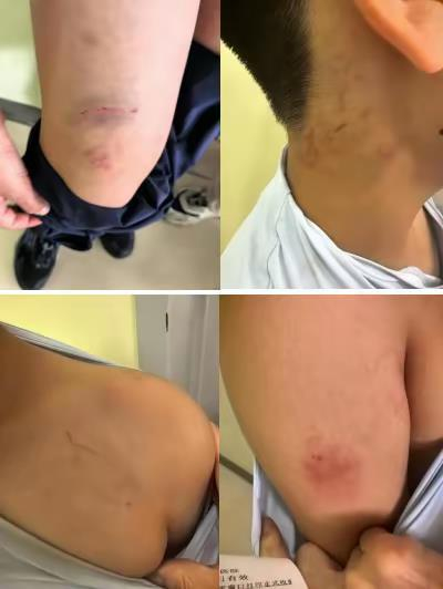 　男孩身上有多处伤痕（视频截图）