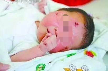 ▲出生后被送到医院时的赵平安