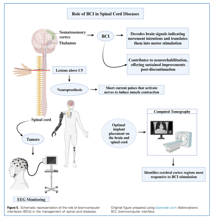 △此图概述了BCI 技术在脊髓疾病中的应用