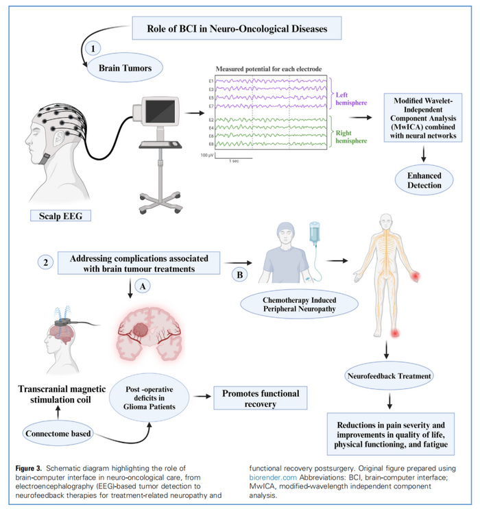 △此图概述了BCI 技术在神经肿瘤疾病中的应用