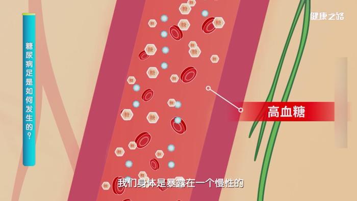 图片来源：电视节目截图