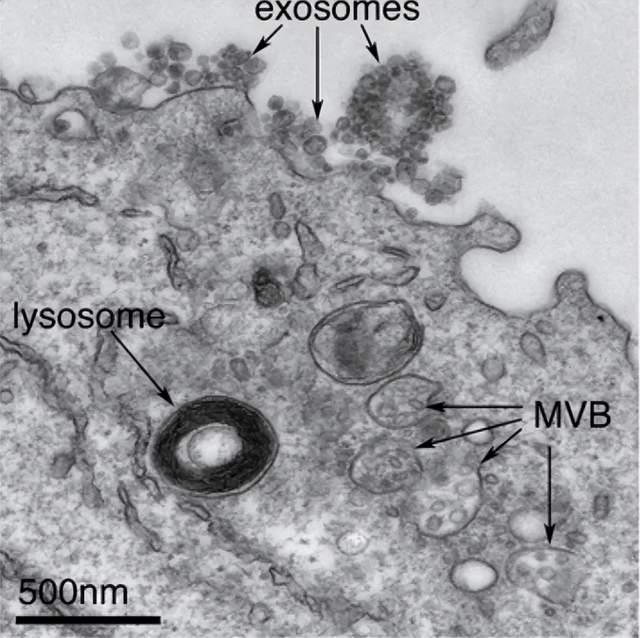 电子显微镜下的外泌体（Exosomes） 来源：网络