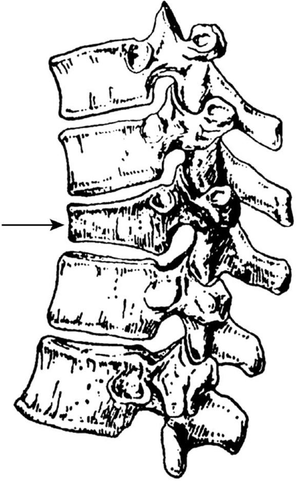 压缩的锥体，图源：作者提供
