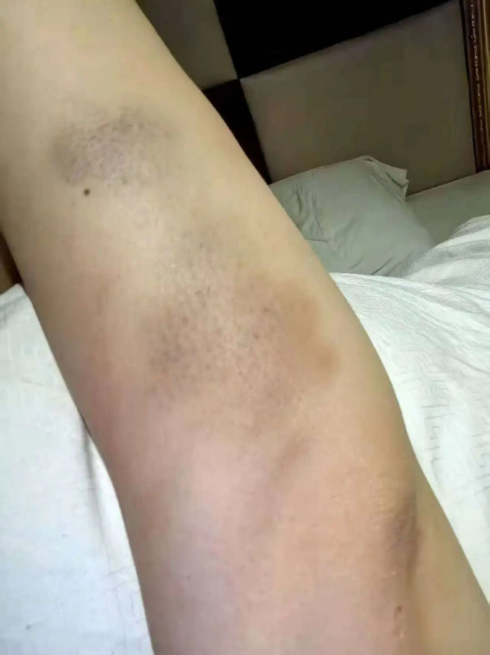 黄某飞称曾被刘某杰家暴 图据受访者