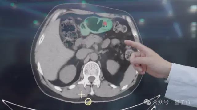 △医生在看DAMO GRAPE的识别结果