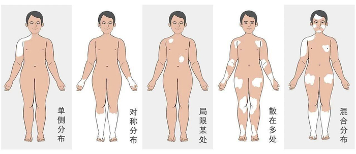 图片来源：网络