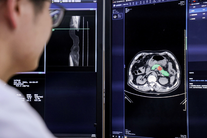 达摩院研发“一扫多查”医疗