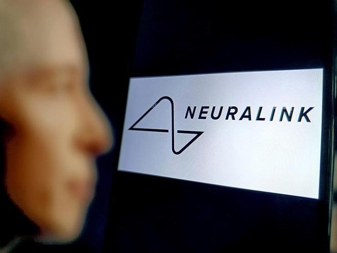 马斯克旗下脑机接口公司Neuralink 资料图 图源：视觉中国