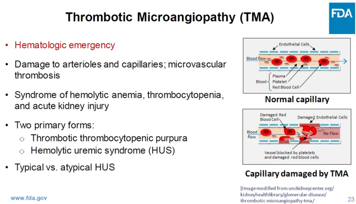 图 4 TMA作用机制