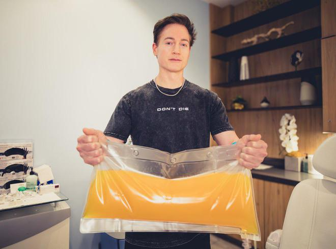 布莱恩用5%白蛋白、静脉注射免疫球蛋白置换血浆；图源：X