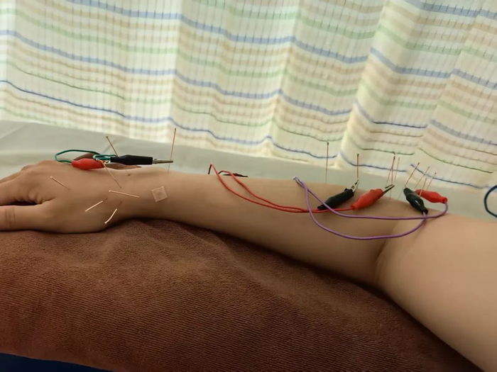 赵欣怡去医院治疗。受访者供图