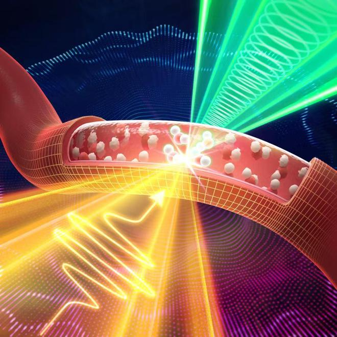　　太赫兹光声可在体无标记检测血钠离子。（受访者供图）