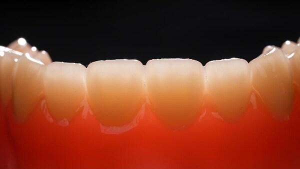 多材料一体打印活动义齿，图片来源：企业供图