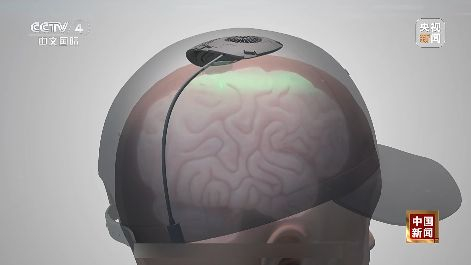 图片来源：央视新闻