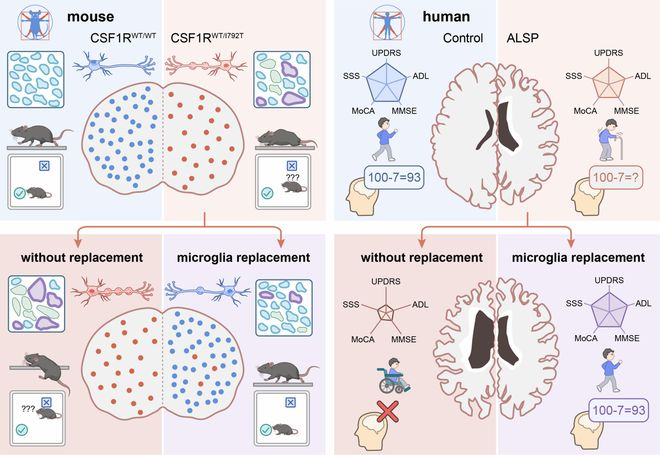▲基于小胶质细胞替换的细胞治疗策略