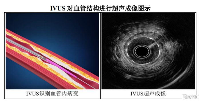 IVUS对血管结构进行超声成像图示，来源：招股书