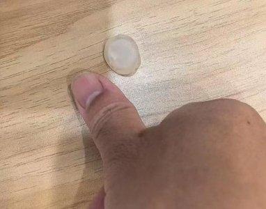 冰雹与大拇指一般大小。　　受访者供图