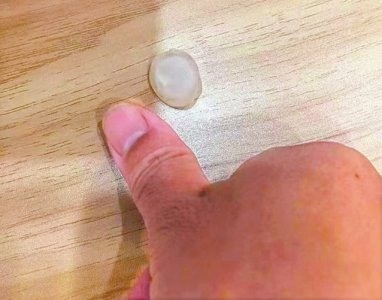 冰雹与大拇指一般大小。 受访者供图