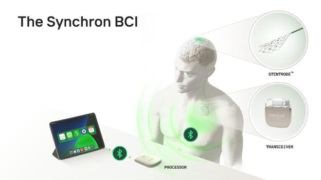 ▲脑机接口人机交互设备（BCI）系统概述（来源：Synchron）