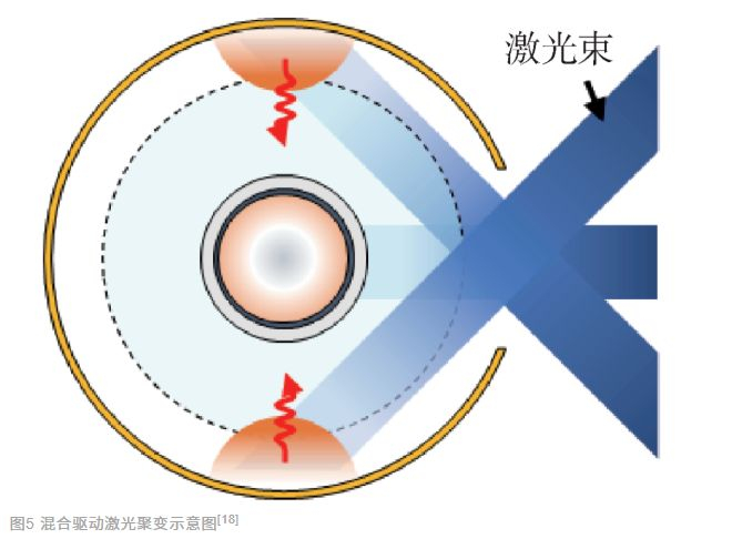  混合驱动激光聚变示意图 图片来源：“浅谈激光聚变”
