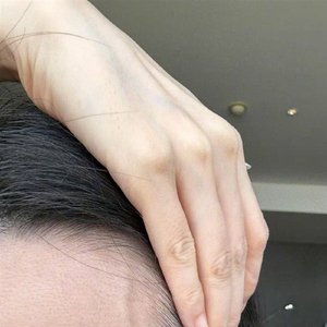 张靓颖自曝体检查出营养不良：额头血管莫名突起伸懒腰手掌就流血_手机 ...