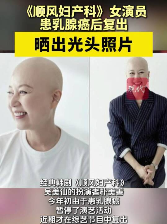 朴美善光头造型