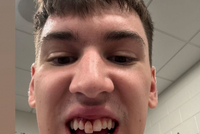 门牙献祭了？拉拉维亚晒自拍：为这次客场之旅画上圆满句号