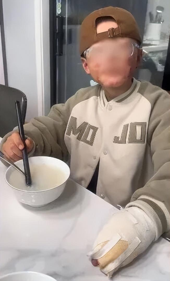 受伤的孩子。图源：河南广播电视台民生频道《大参考》栏目