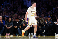 拉拉维亚谈门牙松动：不能大口啃苹果了 我是苹果爱好者