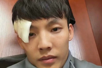 眉骨缝了3针！徐杰晒照：新赛季 为广东而战 兄弟齐心 开门红