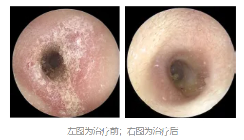 图源：作者提供的门诊病例