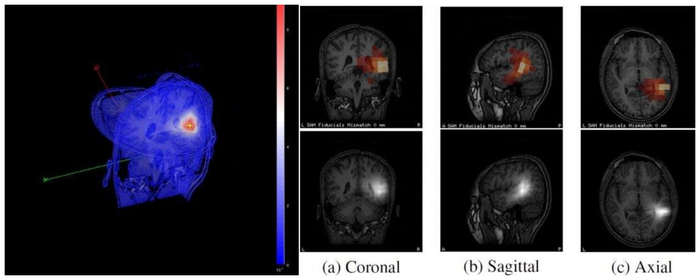 ▲MRI图像可视化系统CTF-SAM-OUT的图像演示（图源：Source Forge）