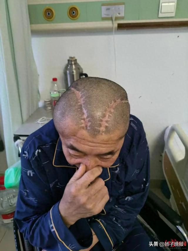 ▲术后的王先生