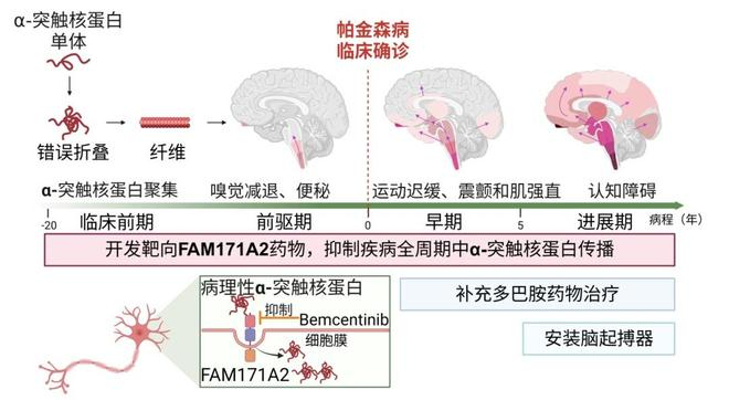 开发靶向fam171a2新药有望构建帕金森病标本兼治新体系。复旦大学供图