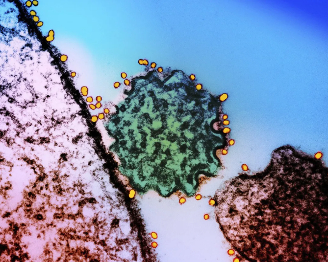 　　△透射电子显微镜看尼帕病毒。