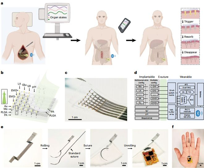 图丨设计概念与系统特性（来源：Nature Biomedical Engineering）