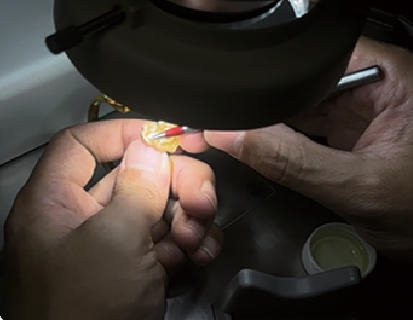 　　图为“打金”师傅在手镯上镶嵌宝石。