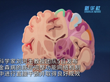 我国科学家世界首次发现帕金森病底层功能网络机制：临床两周有效率 55.5%，国产设备已获批