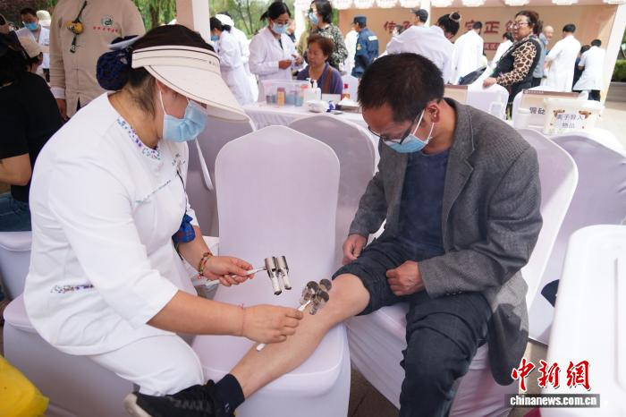  图为西宁市民体验中医热敏灸。　马铭言 摄